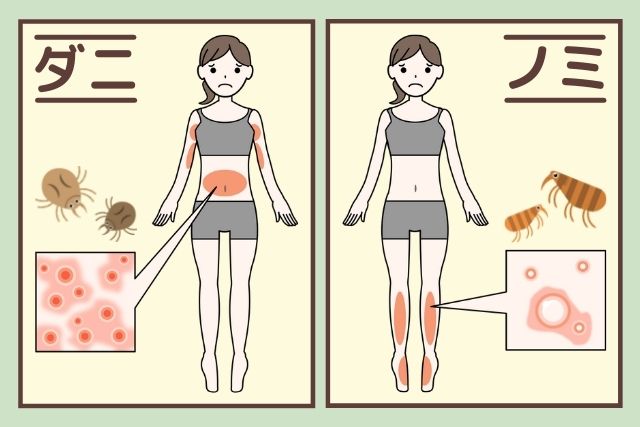 ダニとノミに噛まれたときの症状