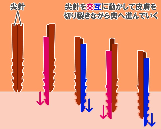 スズメバチ ミツバチ 毒針 刺し方